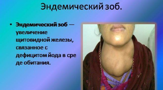 Горло и щитовидка чем связаны Горло и щитовидка чем связаны