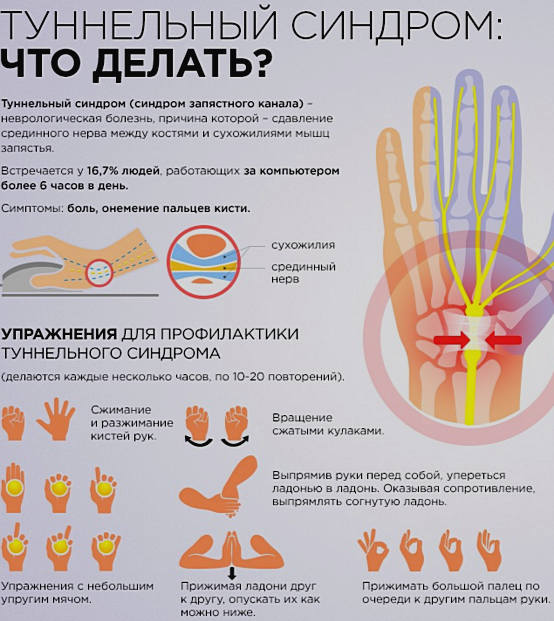 Болят кисти рук после родов что делать