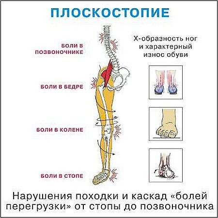 Позвоночник ноют ноги Позвоночник ноют ноги