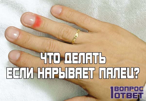 Как лечить аллергическую сыпь по всему телу Как лечить аллергическую сыпь по всему телу