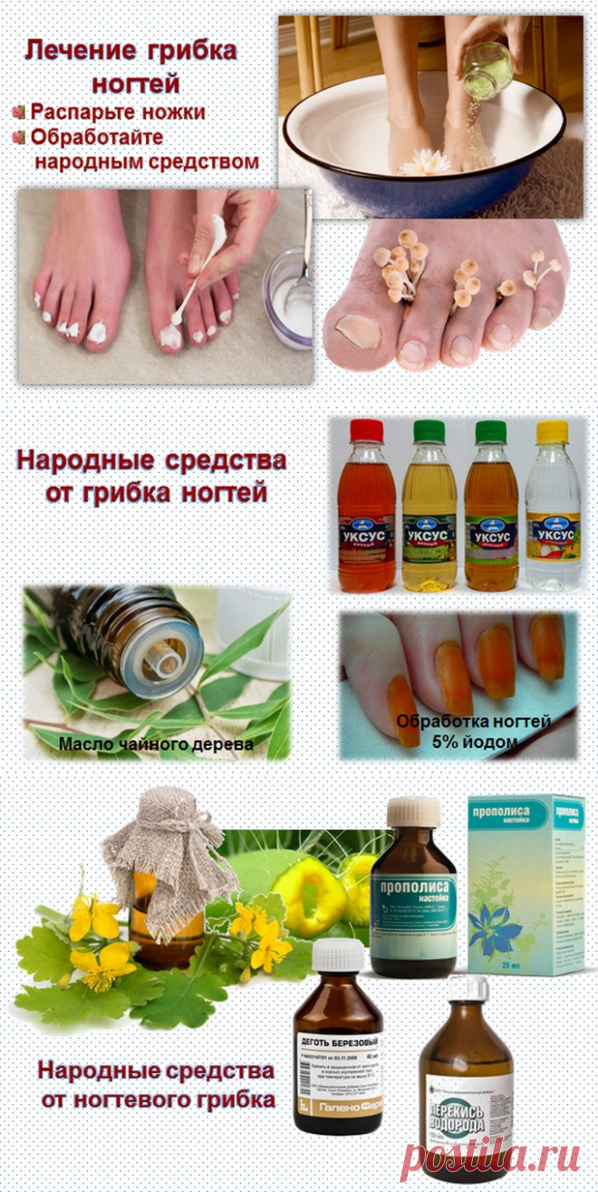 Лечение ногтевого грибка в домашних условиях Лечение ногтевого грибка в домашних условиях