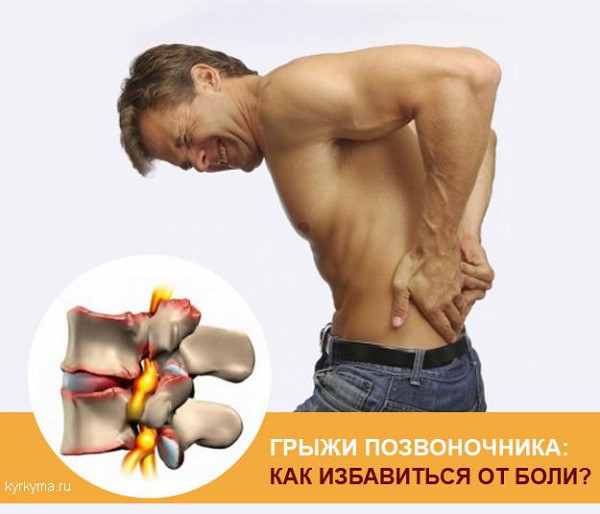 Как вылечить остеохондроз домашним условием Как вылечить остеохондроз домашним условием