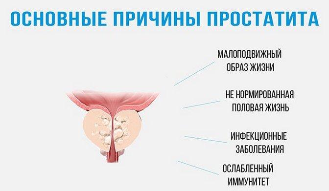 Лечение простатита и причина заболевание Лечение простатита и причина заболевание