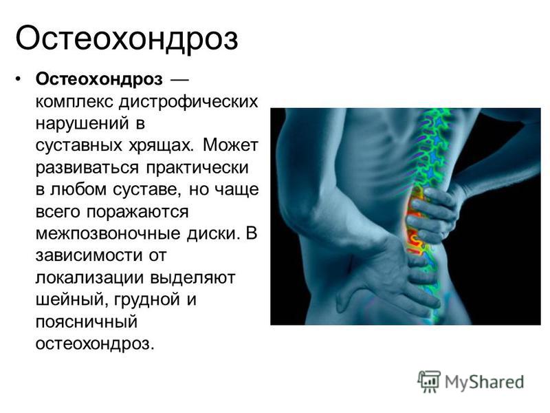 Изолированный остеохондроз это Изолированный остеохондроз это
