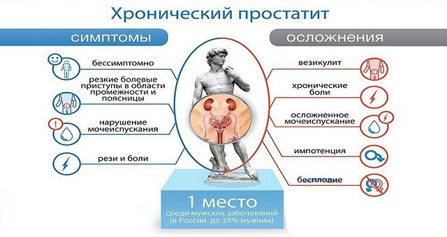 Массаж простаты: польза и вред, как делать в домашних условиях Калькулёзный простатит - камни в протоках