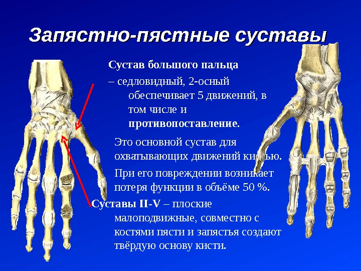 Запястно пястный сустав i пальца артроз Запястно пястный сустав i пальца артроз