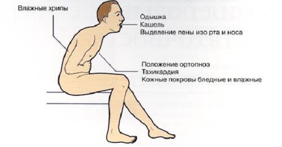 Чем лечить отдышку в домашних условиях Чем лечить отдышку в домашних условиях