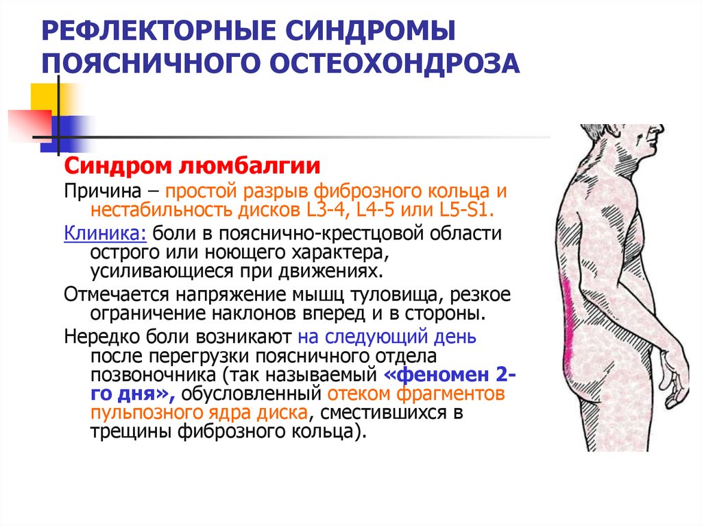 Вакуум терапия, лечение спины, применение и описание Бурсит коленного сустава - симптомы и лечение, в домашних условиях