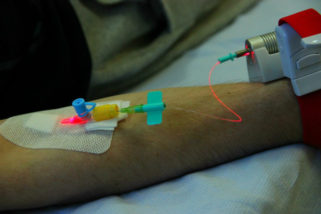 Влок внутривенное лазерное облучение крови показания в гинекологии